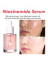 SHEIN Niacinamide Serum, Brightening & Moisturizing Facial Serum1