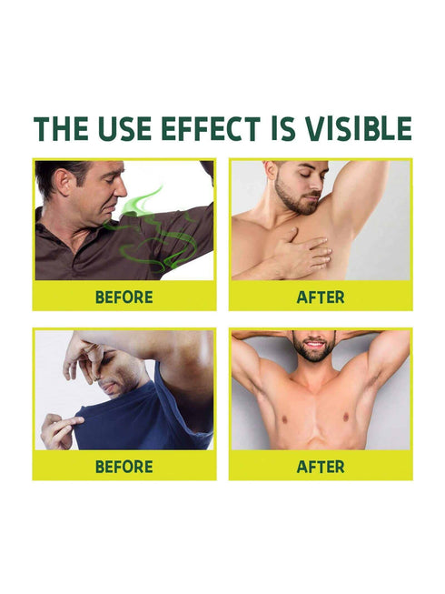 صابون مزيل للروائح من شين